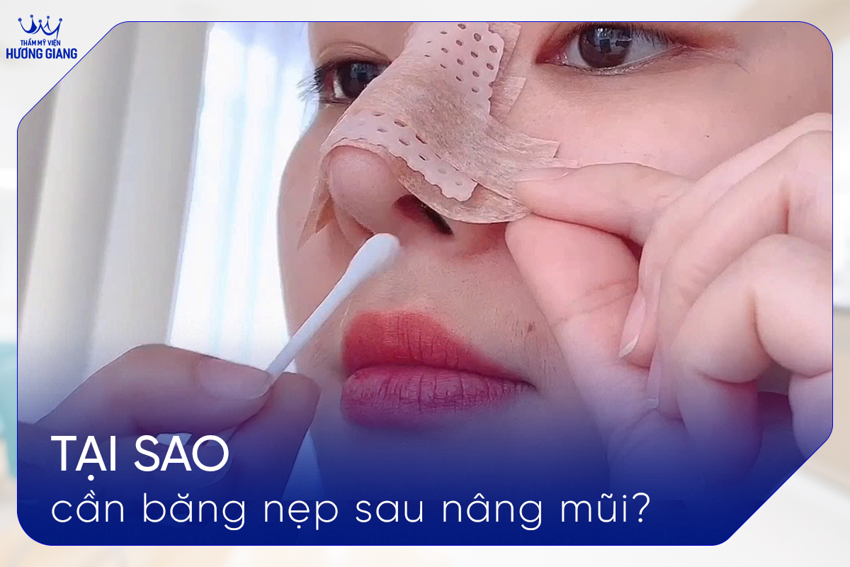 TẠI SAO CẦN BĂNG NẸP SAU NÂNG MŨI?