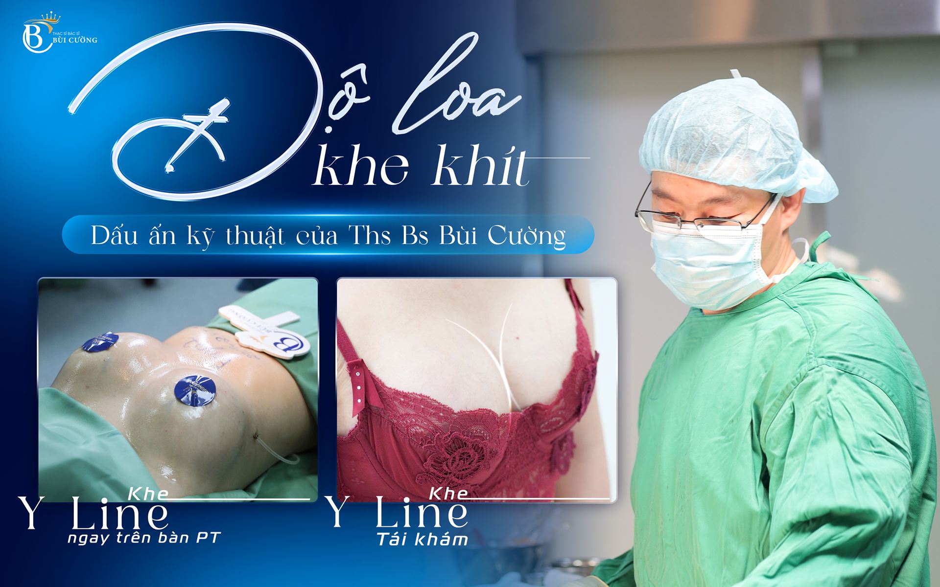 Nâng ngực khe khít - Dấu ấn kỹ thuật của Ths.BS Bùi Văn Cường