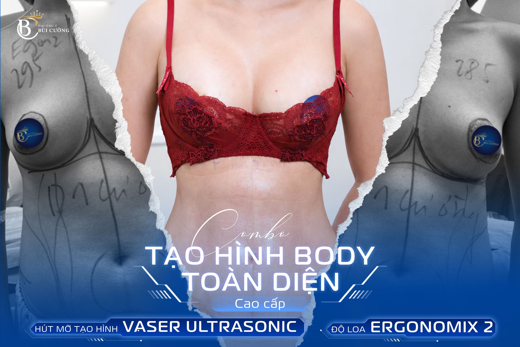 Combo tạo hình body toàn diện: Mẹ 2 con lột xác vóc dáng sau 10 ngày