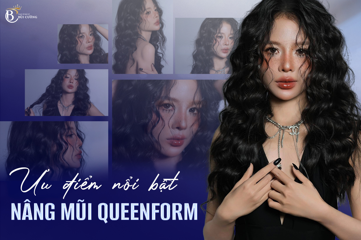 Ưu điểm nâng mũi QueenForm: Khác biệt tạo nên đẳng cấp