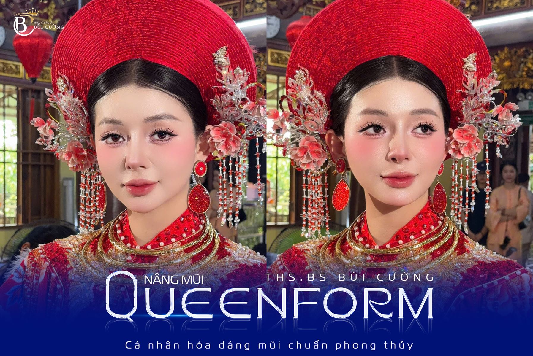 Tạo hình gương mặt toàn diện: Kiến tạo đường nét hài hòa, cân đối cho gương mặt