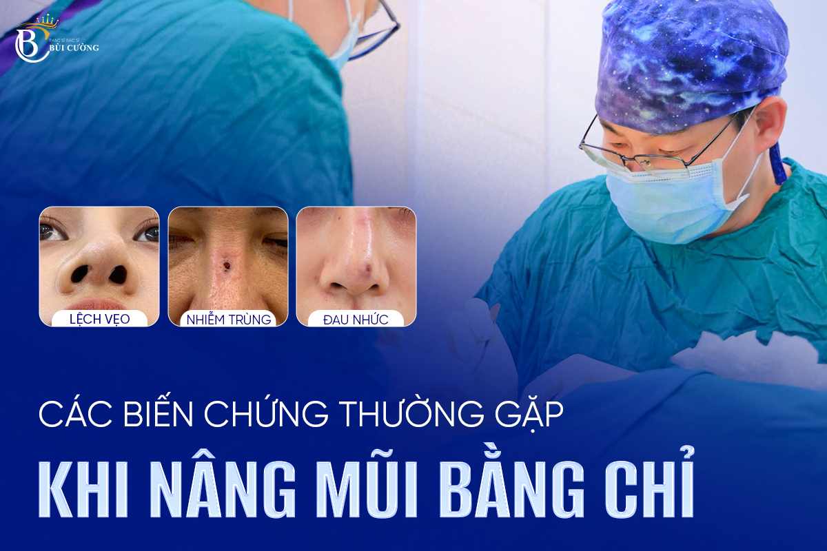 Nâng mũi bằng chỉ sinh học: ĐẸP NHANH hay RỦI RO TIỀM ẨN?