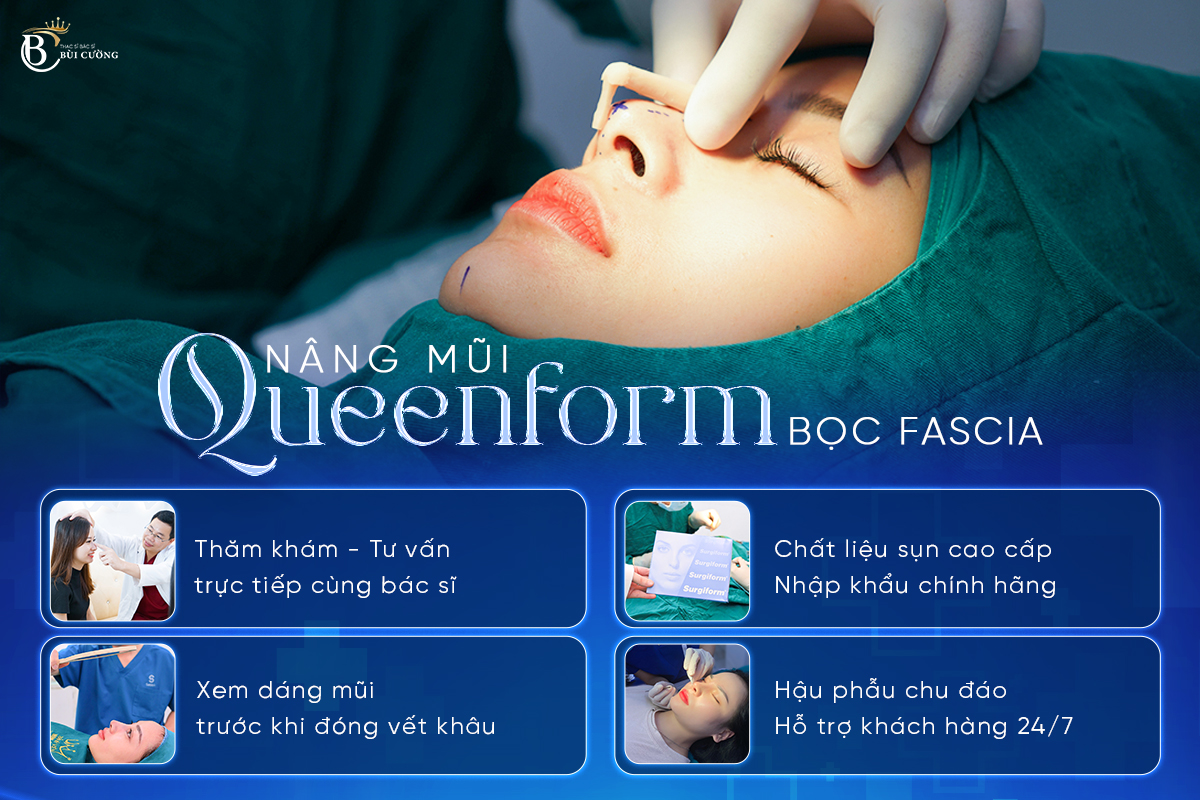 Nâng mũi Queenform bọc Fascia - 4 đặc quyền khác biệt chỉ có tại Ths.BS Bùi Văn Cường