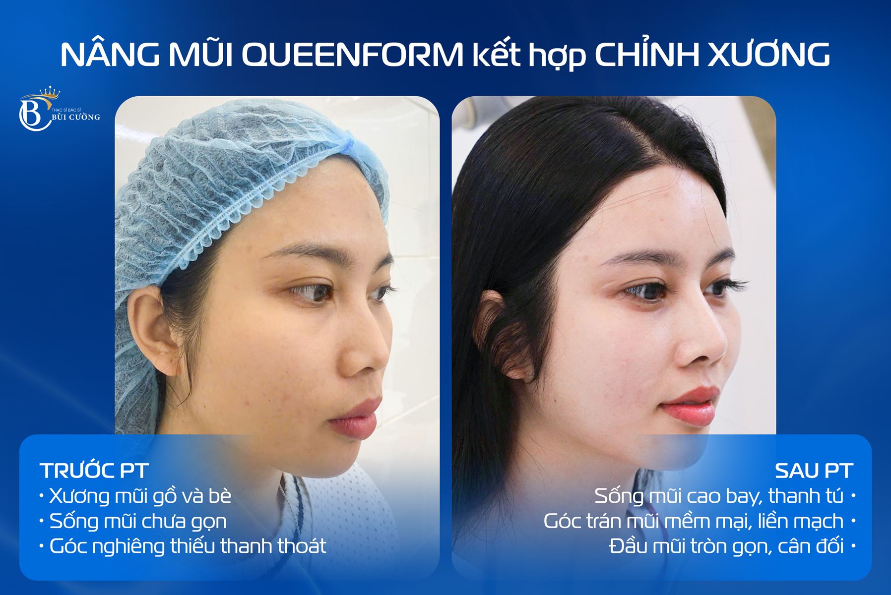Case dịch vụ gương mặt nổi bật trong tuần: Những thay đổi giúp đường nét hài hòa, thanh tú hơn 