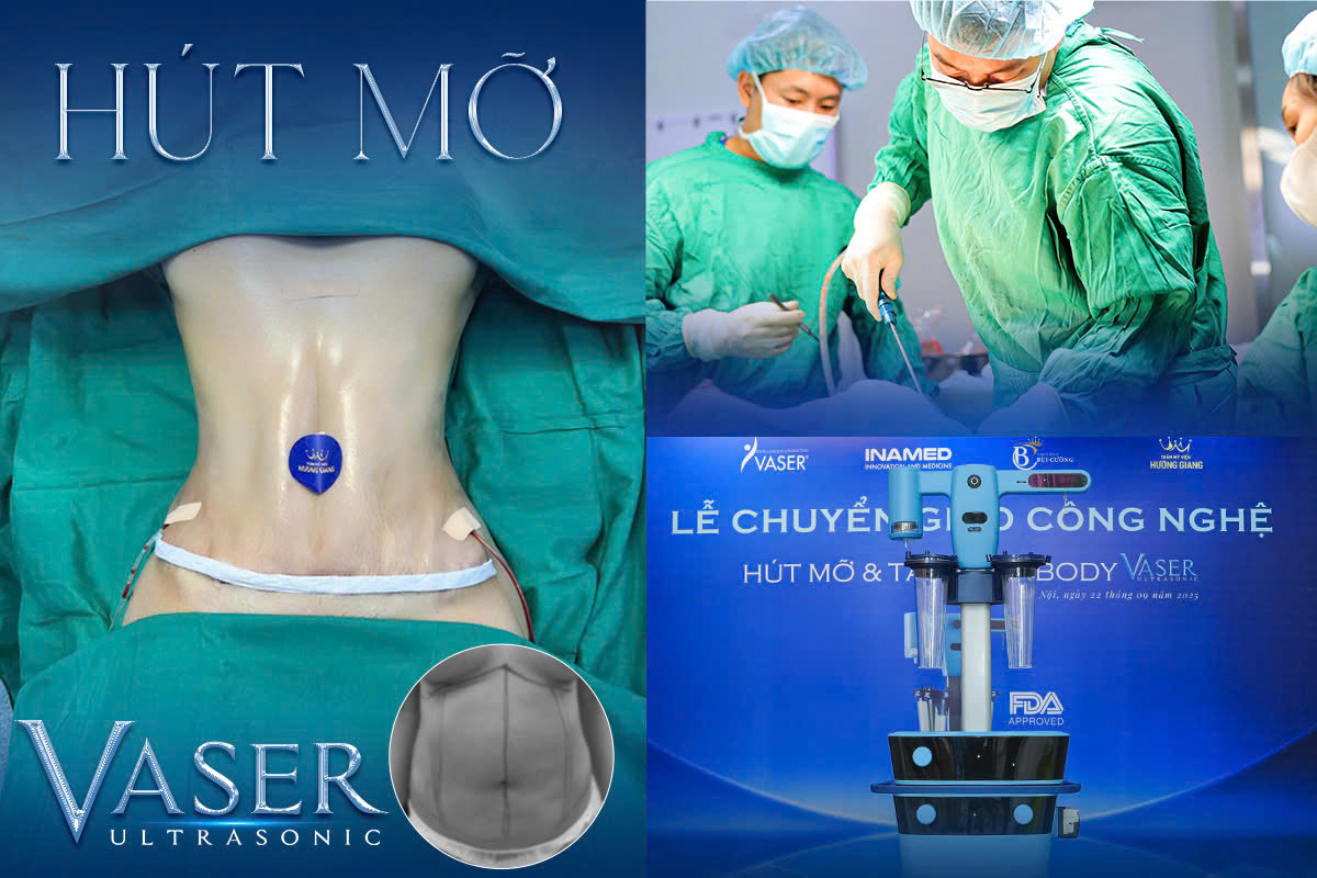 Ths.BS Bùi Văn Cường - Đón đầu xu hướng tạo hình body toàn diện